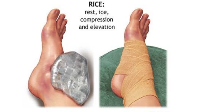 Hal yang Tidak Boleh Dilakukan Saat Mengalami Keseleo